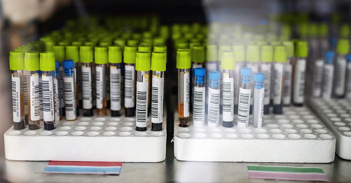 New Test Predicts Colorectal Cancer Risk In IBD Patients New Test Predicts Colorectal Cancer Risk In IBD Patients